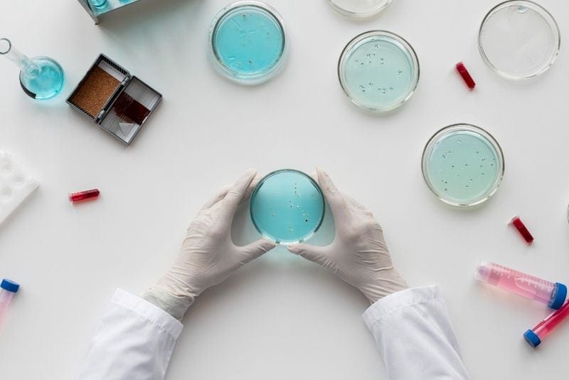 scientist-holding-bacterial-culture-petri-dish